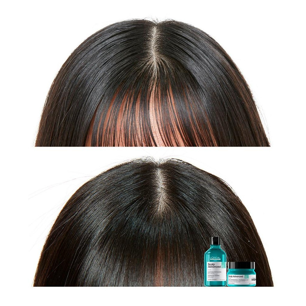 L'Oréal Scalp Advanced Anti-Oiliness Dermo-Purifier Shampoo 300Ml