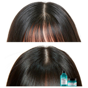 L'Oréal Scalp Advanced...