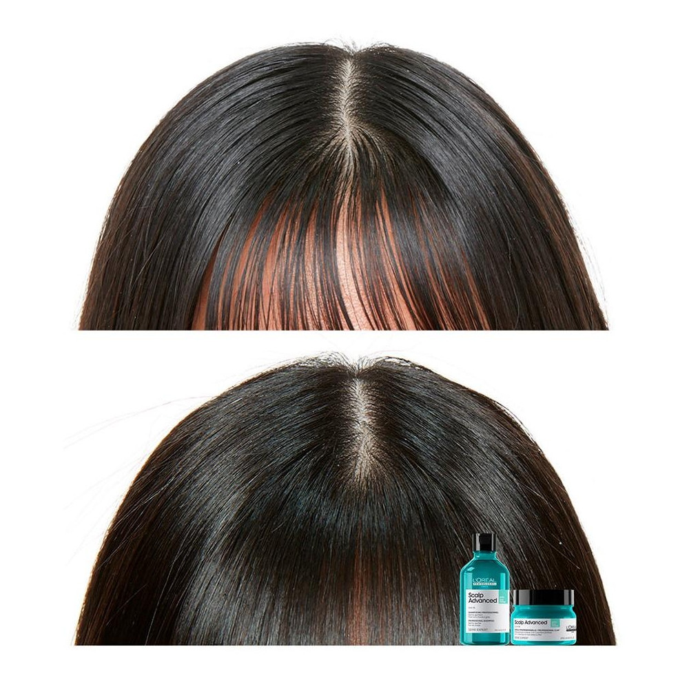 L'Oréal Scalp Advanced Anti-Oiliness 2In1 Deep Purifier Clay 250Ml