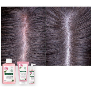 Klorane Gel Después Del Champú Al Extracto De Peonia 150Ml