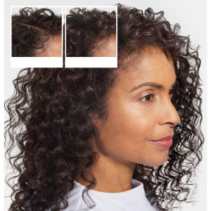 Champú Anticaída - Champú Para La Caída Del Cabello 475 Ml