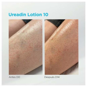 Sesderma Ureadin Hydration Loción Hidratación Intensa 10% Urea 1000Ml