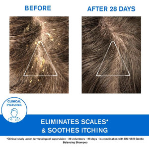 Ds Hair Champú De Tratamiento Queratorreductor 150 Ml