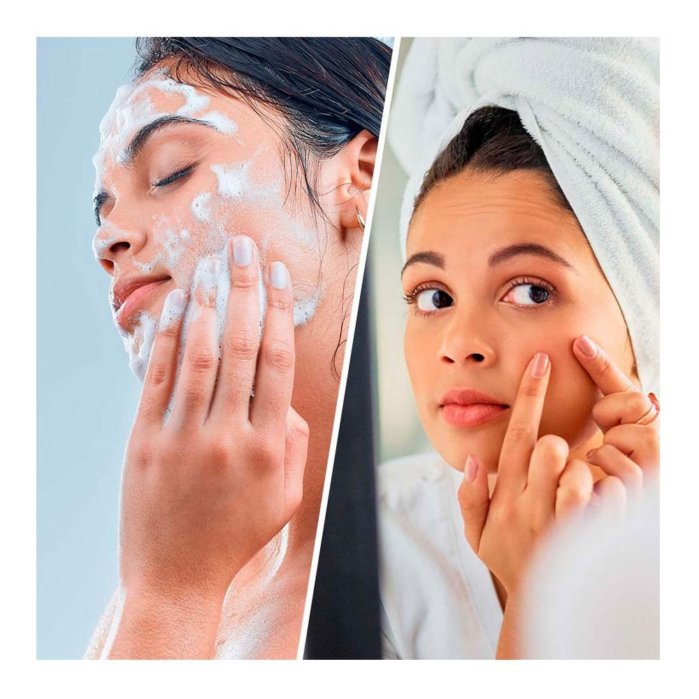 Salicyclic Super Cleanser Face Y Body Blackhead + Breakout 200 Ml