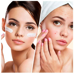 Blemish Control Clear Complexion Facial Moisturizer Lotion 50 Ml